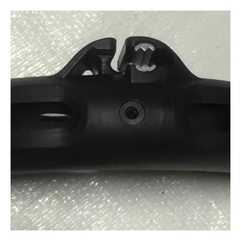 AL360 Back End Replacement